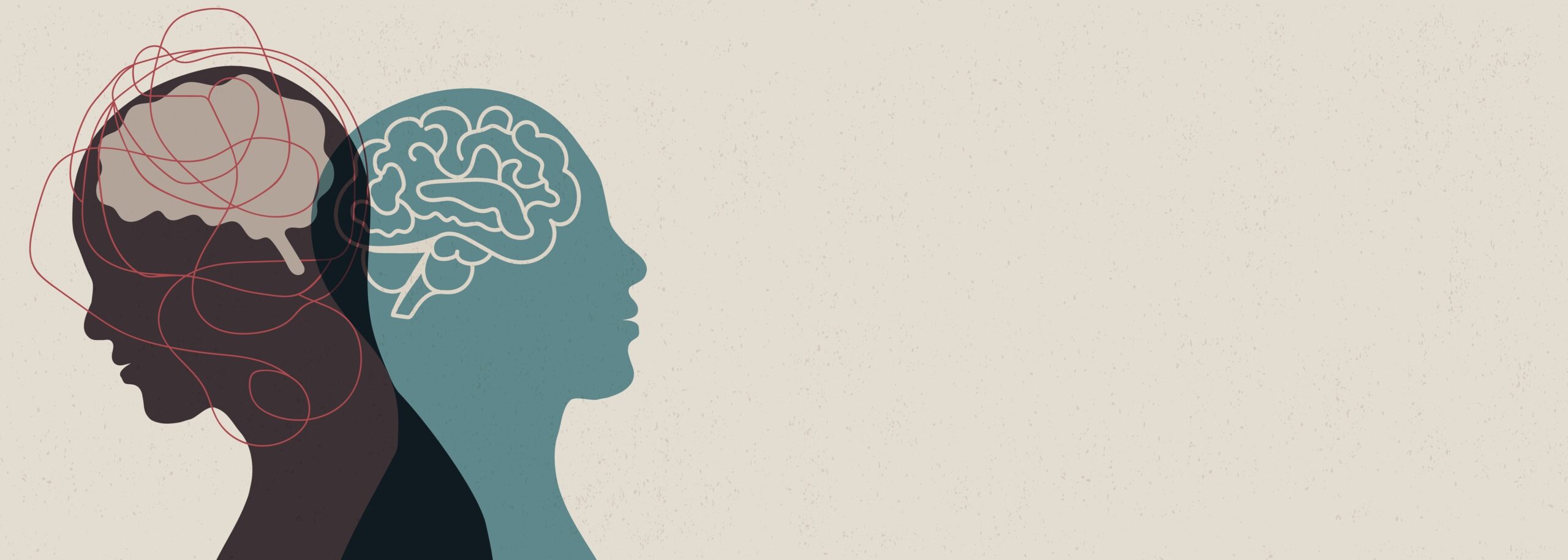 Understanding Bipolar Disorder: A Guide to its Symptoms and its Impact
